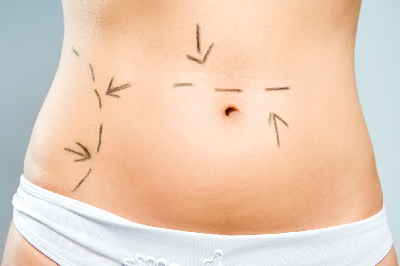 A patient in Fort Worth excitedly awaits a tummy tuck procedure.